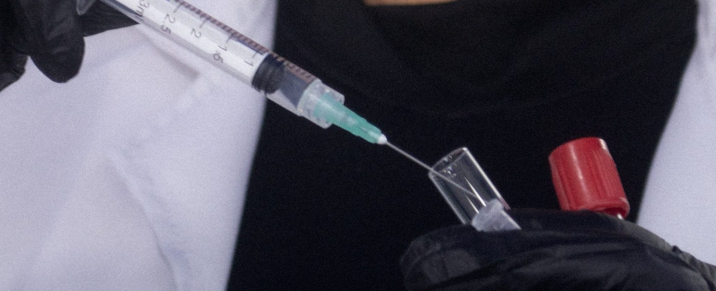 LABORATORIO SANGRE TOMA DE MUESTRA Y CONSERVACION DE LA MUESTRA